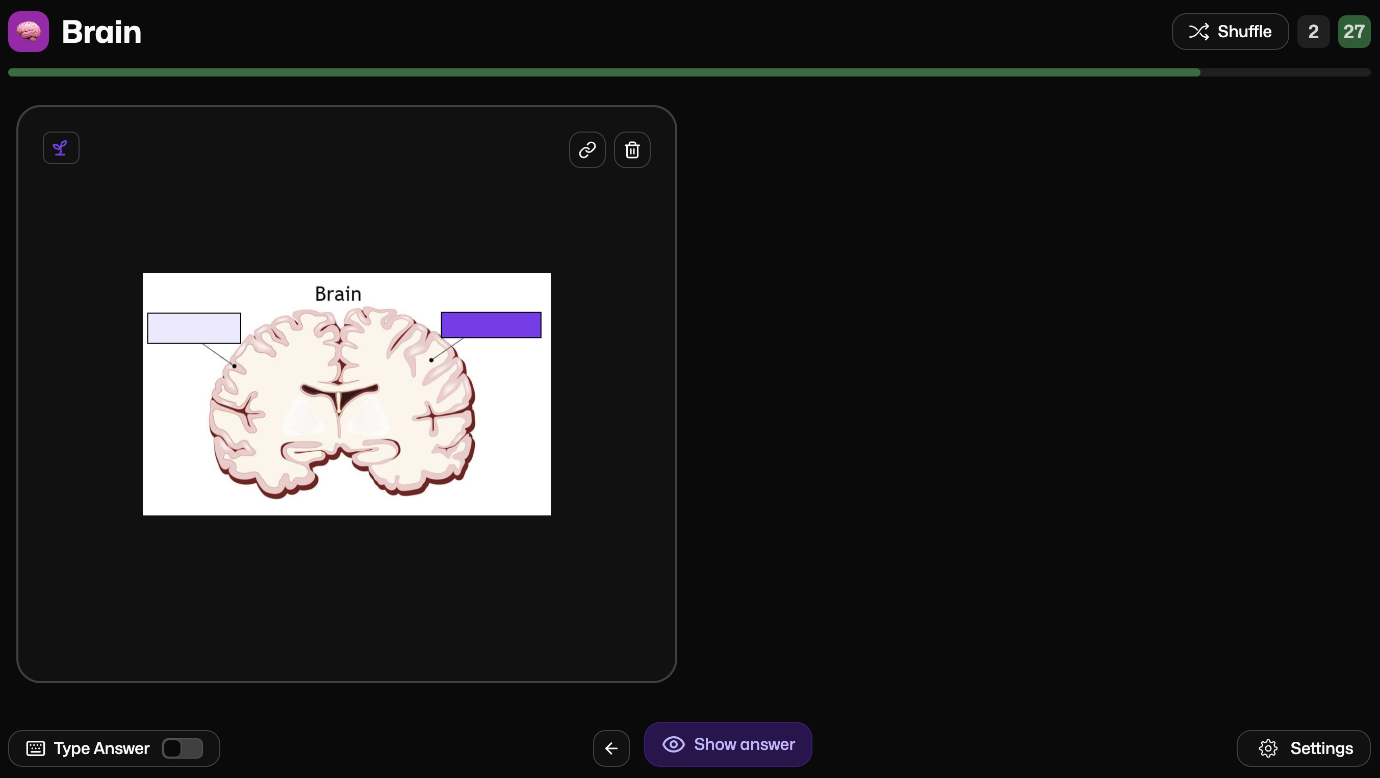 Image Occlusion Flashcards
